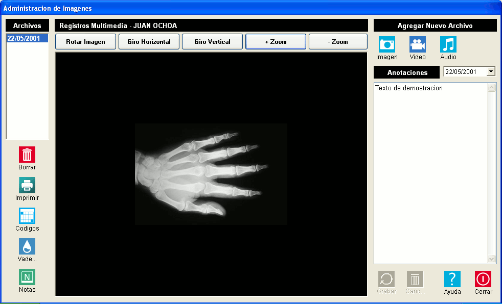 Gestion de Imagenes
