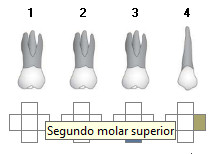 Odontograma